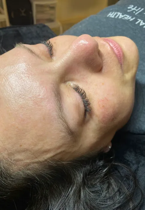 Blushing Esthetics Picture 2