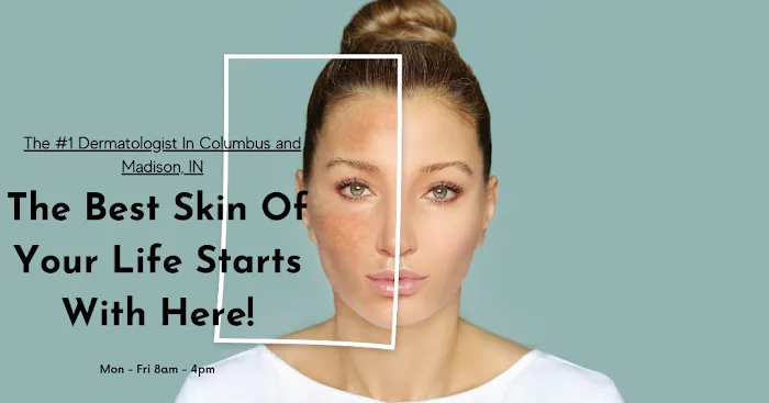 Skin Solutions Dermatology & Aesthetics - Columbus Indiana Picture 7