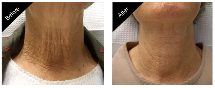 The New You Esthetics Picture 5