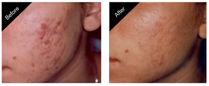 The New You Esthetics Picture 4