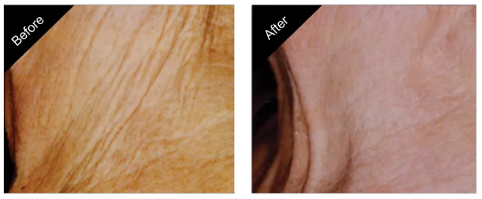 The New You Esthetics Picture 9