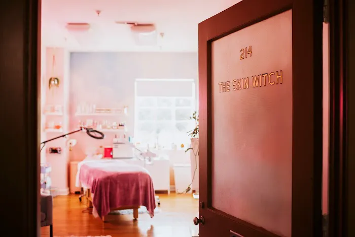 The Skin Witch Picture 3