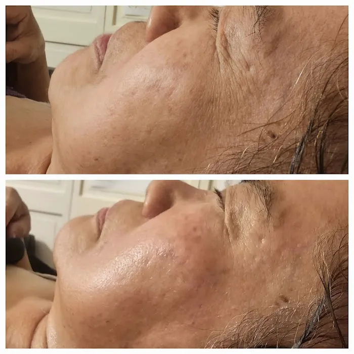 Daisy's Skin Transformation Picture 8