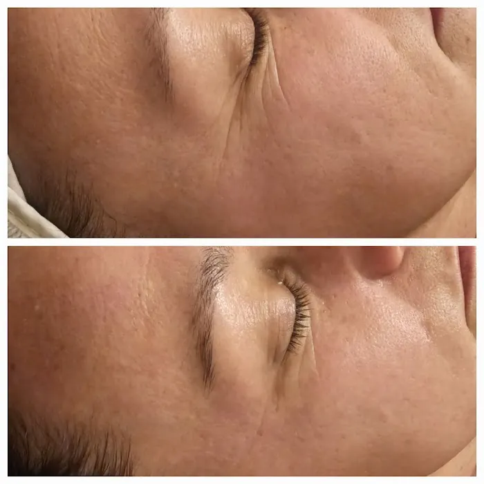 Daisy's Skin Transformation Picture 9