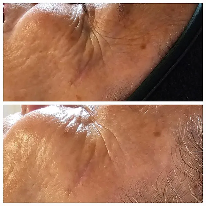 Daisy's Skin Transformation Picture 10