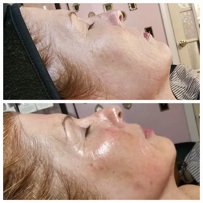 Daisy's Skin Transformation Picture 4