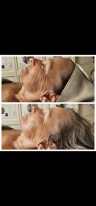 Daisy's Skin Transformation Picture 3