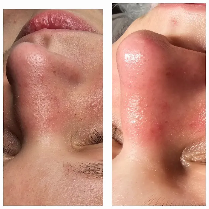 Daisy's Skin Transformation Picture 6