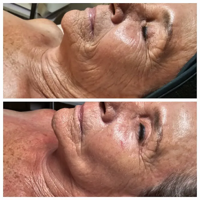 Daisy's Skin Transformation Picture 7