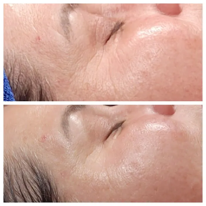 Daisy's Skin Transformation Picture 2