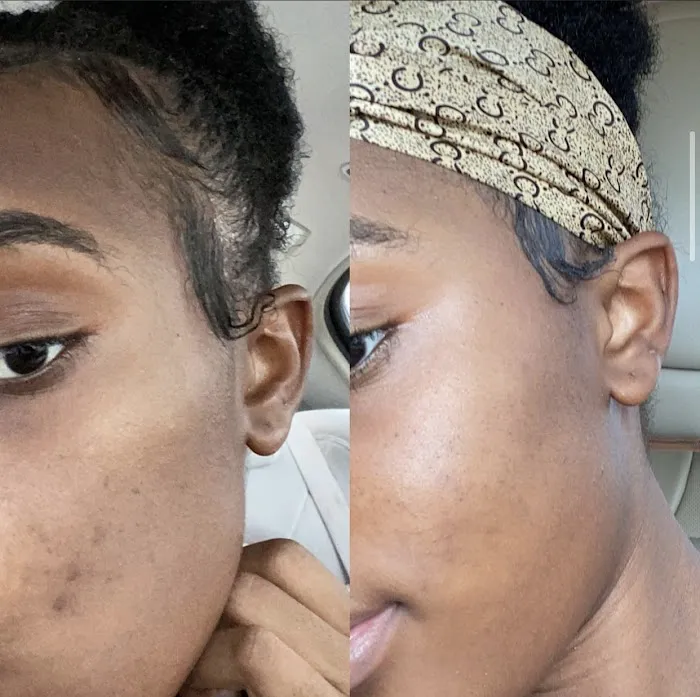 Face II Face Aesthetics Picture 1