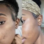 Face II Face Aesthetics