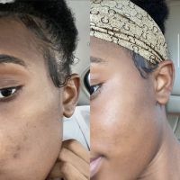 Face II Face Aesthetics ico