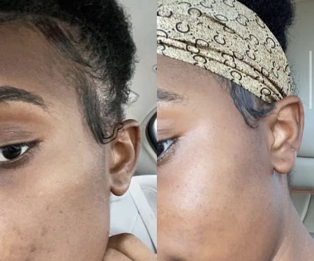 Face II Face Aesthetics