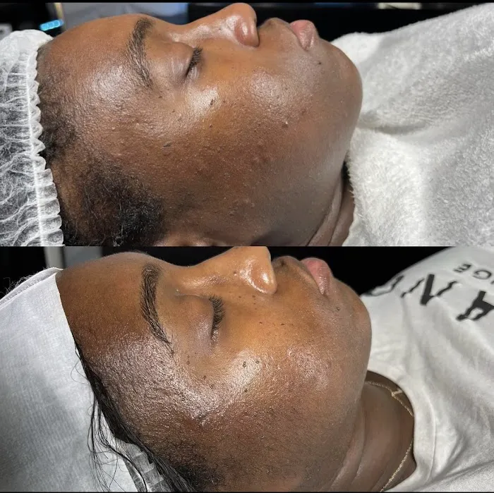 Face II Face Aesthetics Picture 3