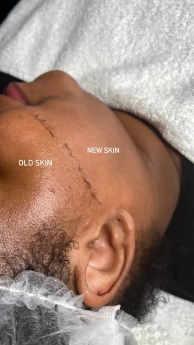 Face II Face Aesthetics Picture 4