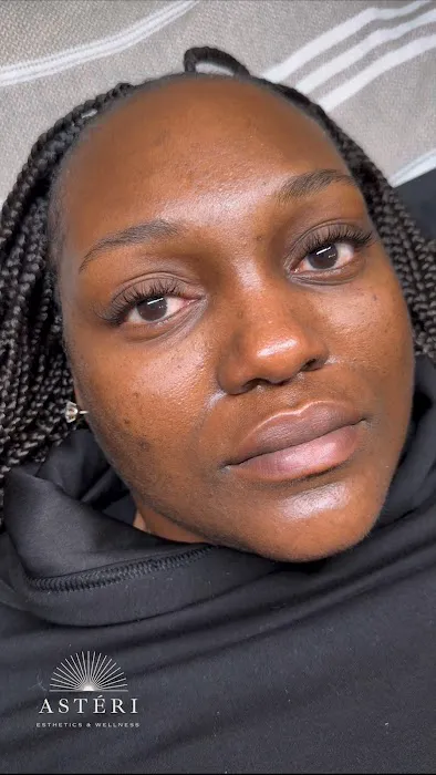 Astéri Esthetics & Wellness Picture 3