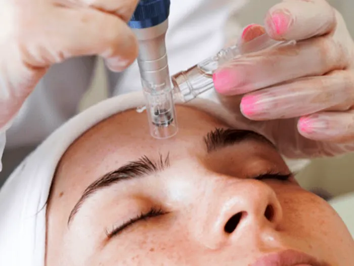 Natural Glowing Skin Picture 3