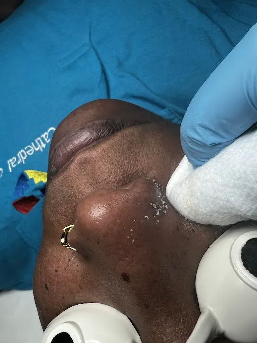 Natural Glowing Skin Picture 5