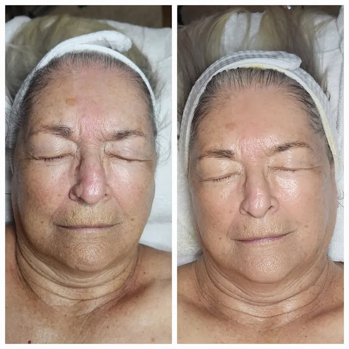 Surf City Skin Care Picture 4