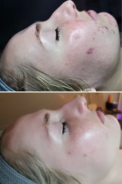 Skin Therapy Picture 8