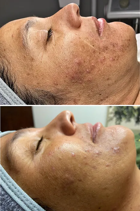 Skin Therapy Picture 9