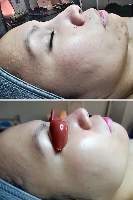 Skin Therapy Picture 10