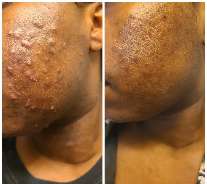 The Skin Alcove Picture 4