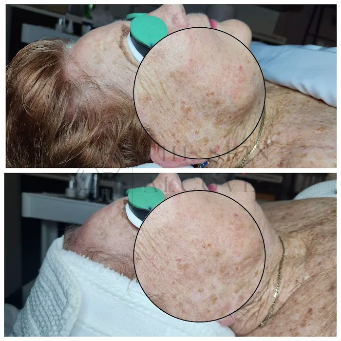 The Skin Alcove Picture 5