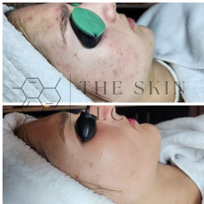 The Skin Alcove Picture 10