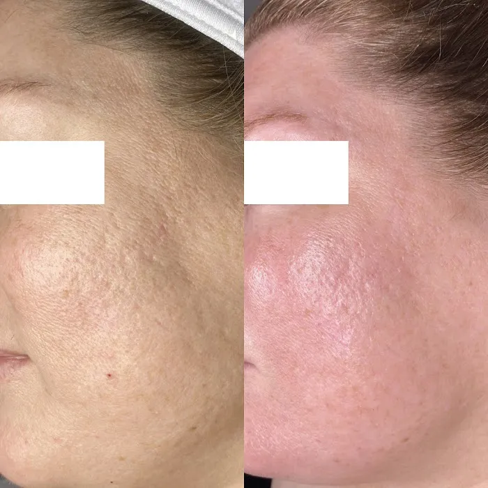 Monarch Skin Therapy Picture 4