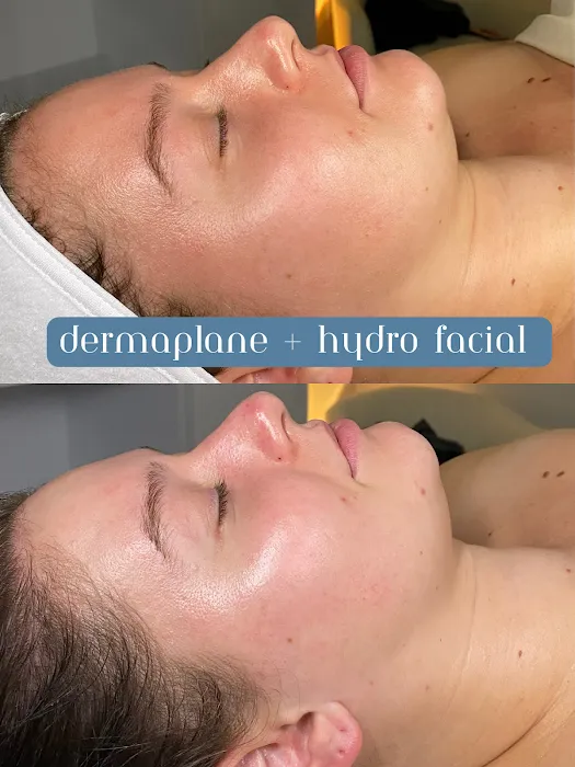 Monarch Skin Therapy Picture 8