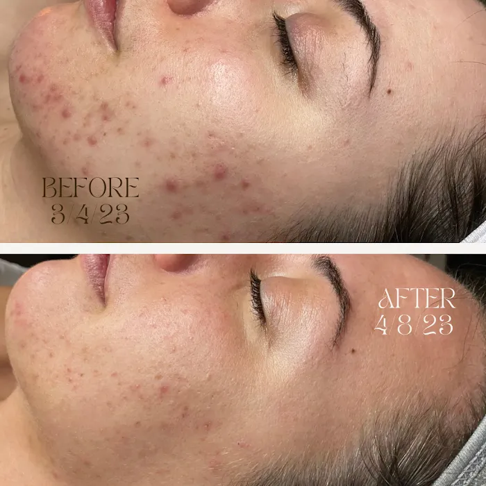 Monarch Skin Therapy Picture 7