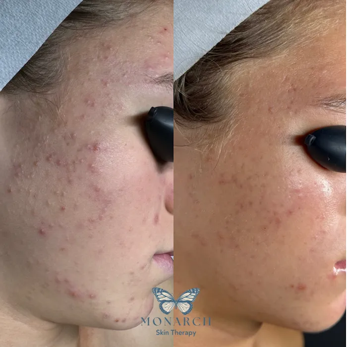 Monarch Skin Therapy Picture 9