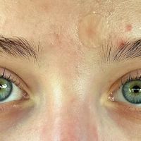 Peaches + Co Aesthetics ico