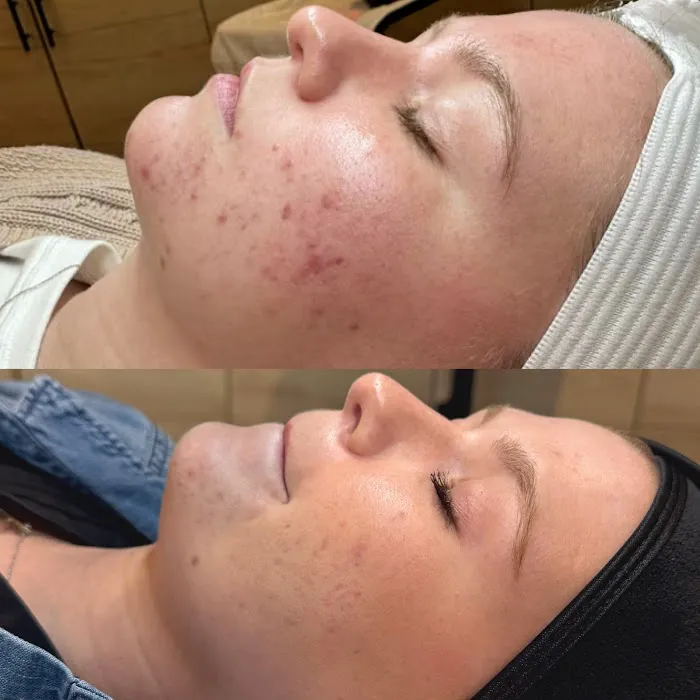 Peaches + Co Aesthetics Picture 4