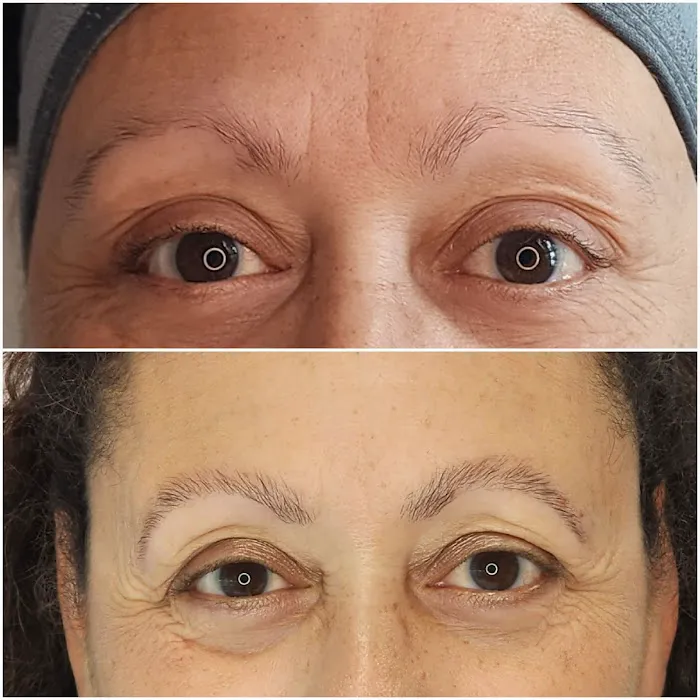 Love Thy Skin Picture 7