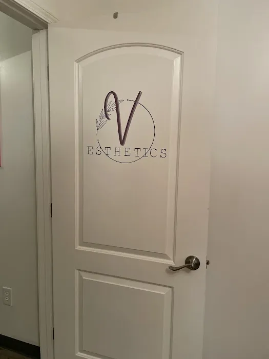 V Esthetics Picture 4