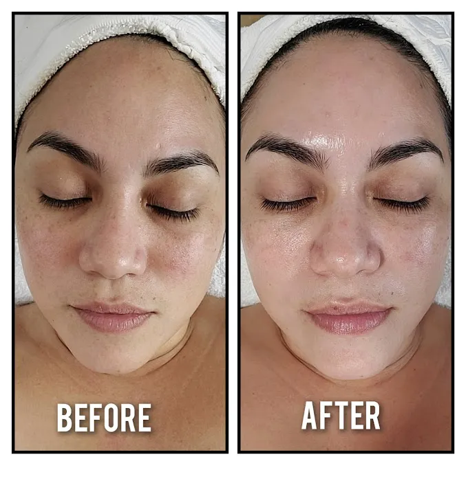 Bella Skin Center Picture 7