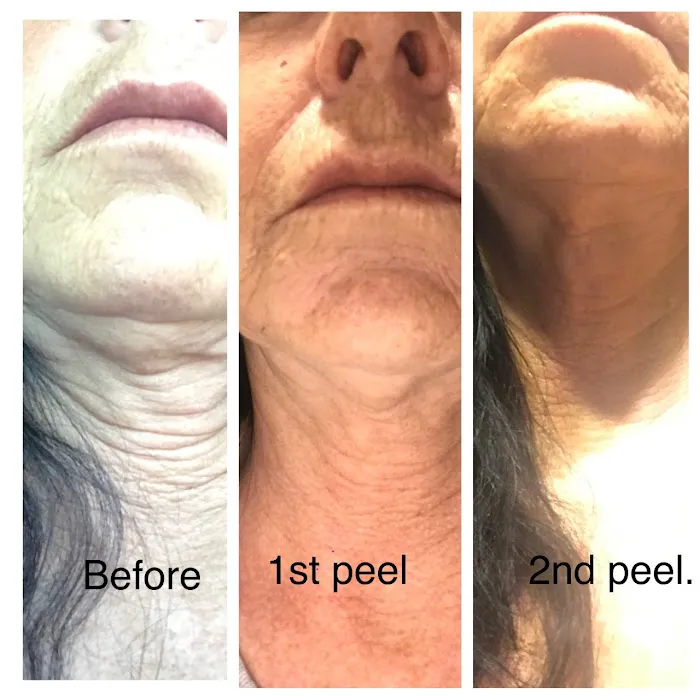 Bellayou Skincare Picture 8