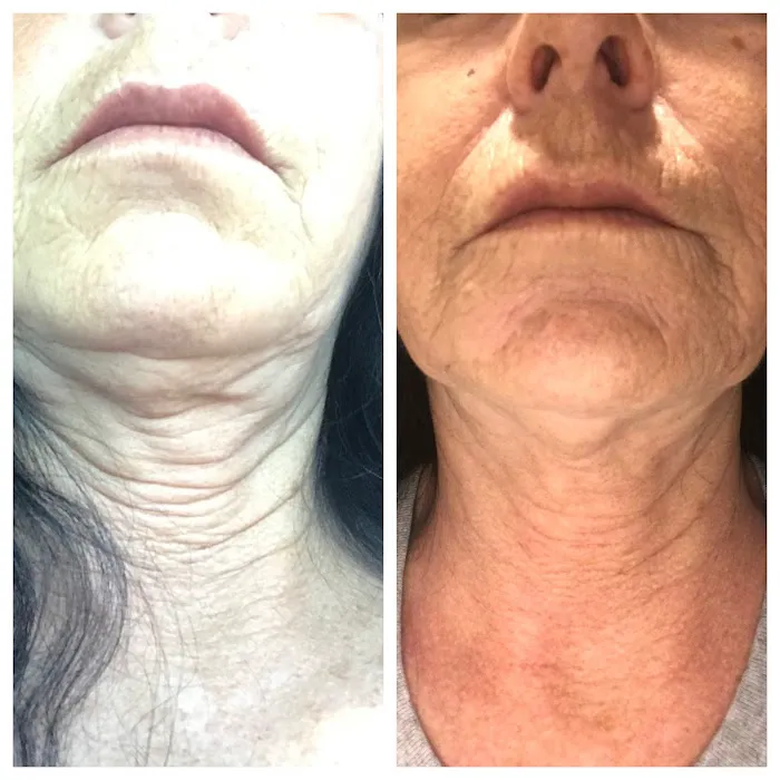 Bellayou Skincare Picture 5