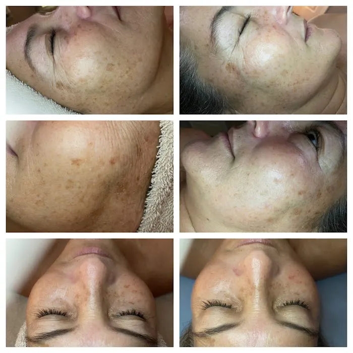 Bellayou Skincare Picture 7