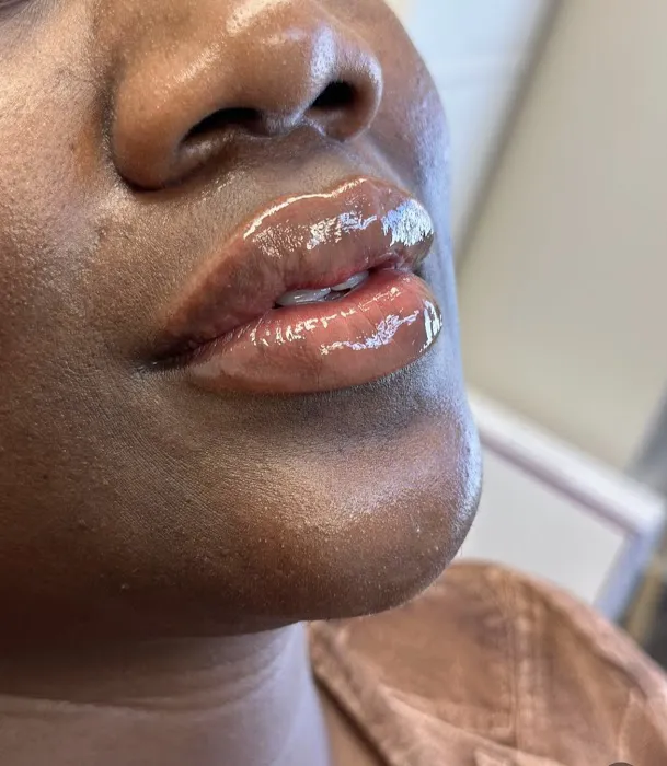 Trinity Wellness & Beauty- Botox, Weight Loss, Microneedling Picture 1