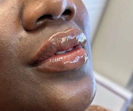 Trinity Wellness & Beauty- Botox, Weight Loss, Microneedling