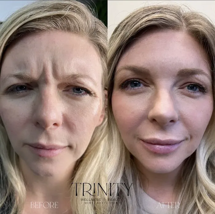 Trinity Wellness & Beauty- Botox, Weight Loss, Microneedling Picture 6