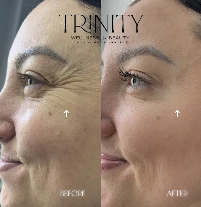 Trinity Wellness & Beauty- Botox, Weight Loss, Microneedling Picture 3