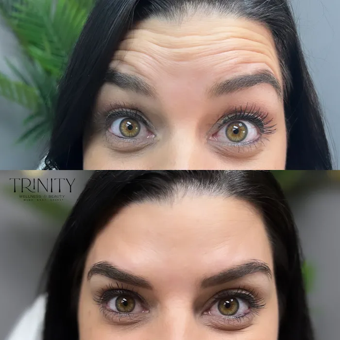 Trinity Wellness & Beauty- Botox, Weight Loss, Microneedling Picture 10