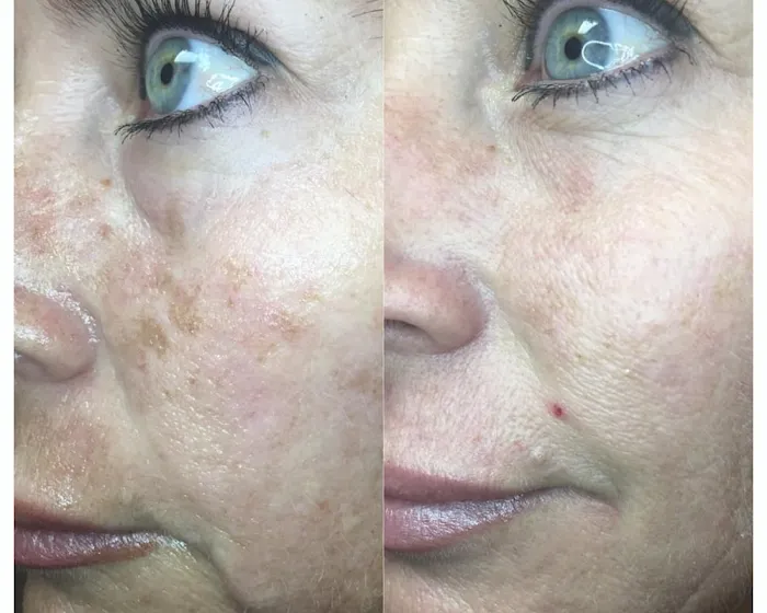 SKIN BLISS STUDIO Picture 7