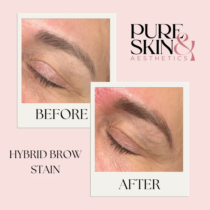 Pure Skin and Aesthetics Picture 2