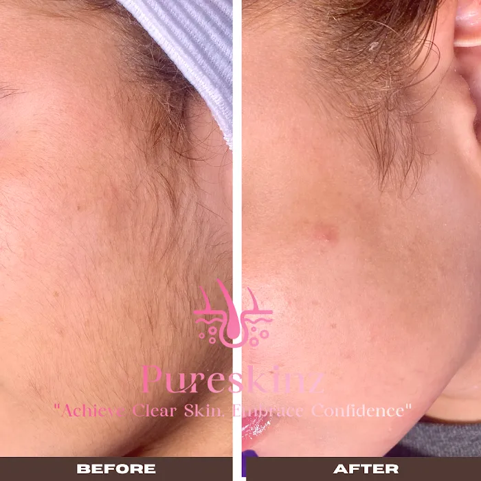 Sacramento Skin Clinic Pureskinz Picture 5